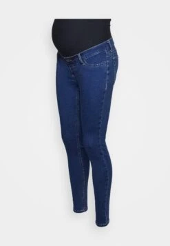 Jeans Skinny - Blue -Anna Field Soldes Boutique 2548f84b1aea4b11b9ae9143ff073454